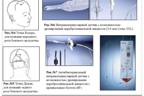Кракен перестал работать